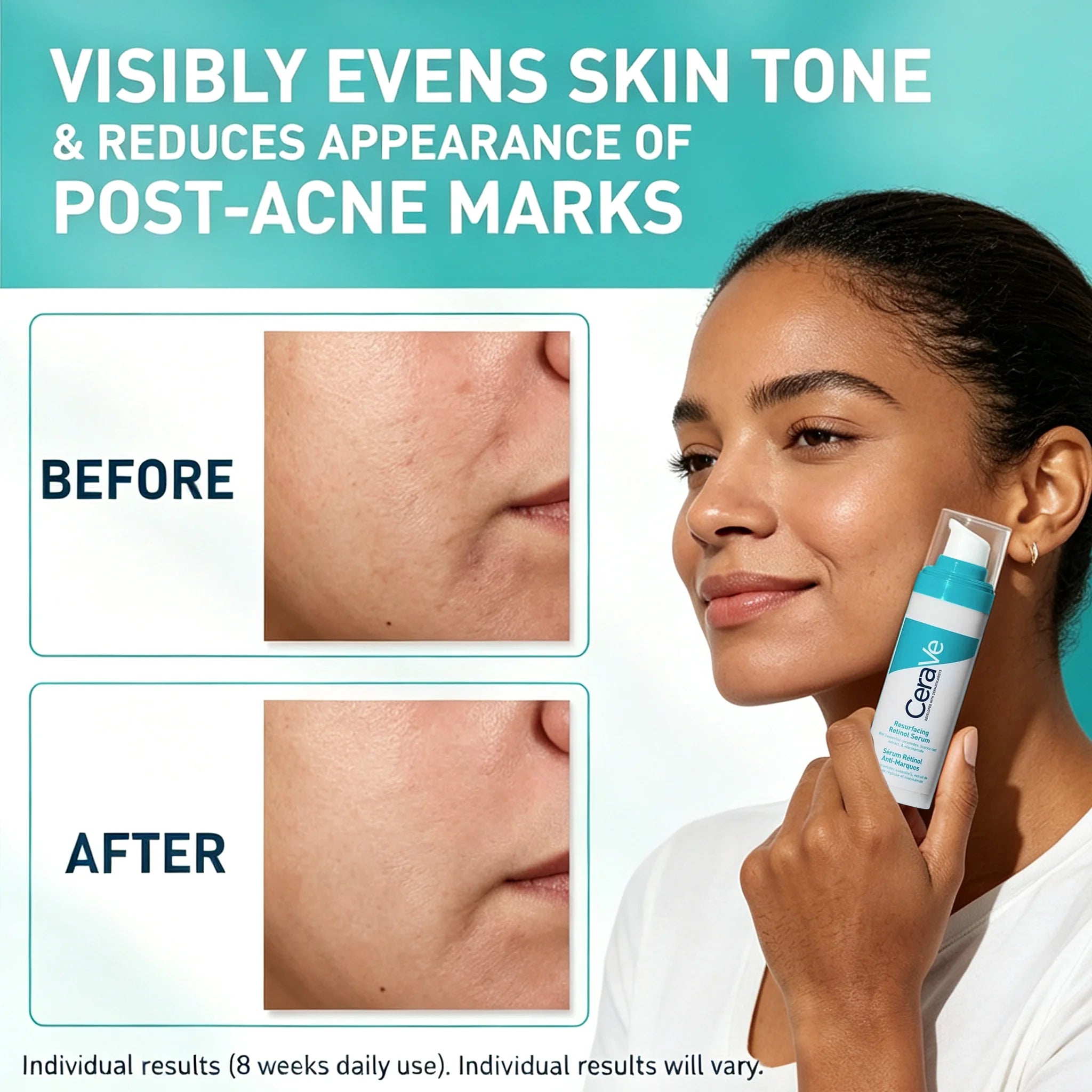 CeraVe Retinol Serum Niacinamide Licorice Root, Skin Smoothing Tone